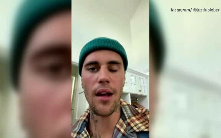 Justin Bieber a dezvăluit că suferă de o paralizie facială: „Nu pot să clipesc cu un ochi”
