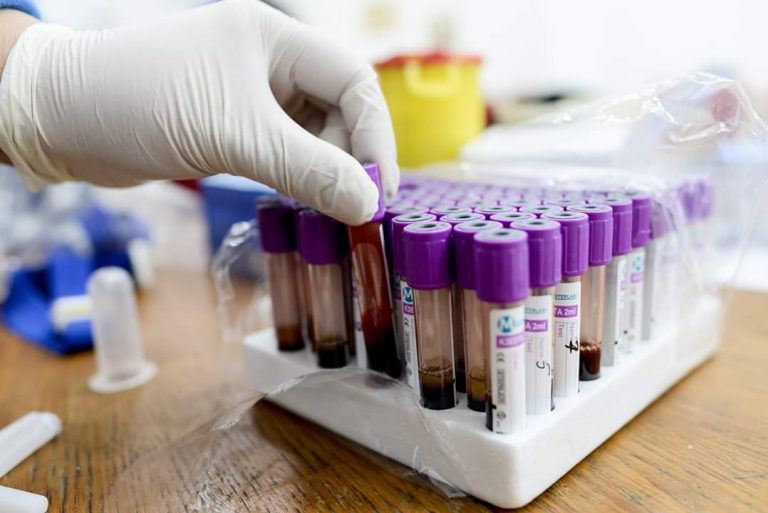 Programul național de depistare a hepatitei C pentru populația defavorizată debutează la Târgu Frumos