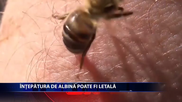 Atunci cand inteapa, albina injecteaza o cantitate de aproximativ 0,3 miligrame de venin