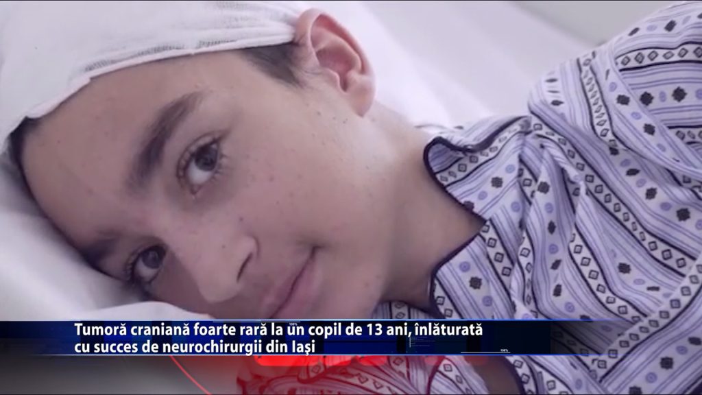 Tumora craniana foarte rara la un copil de 13 ani, inlaturata cu succes de neurochirurgii din Iasi
