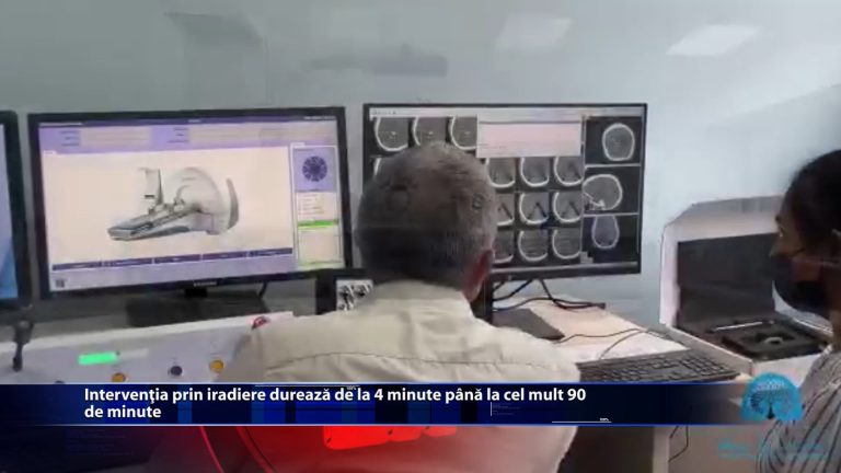 Interventia prin iradiere dureaza de la 4 minute pana la cel mult 90 de minute