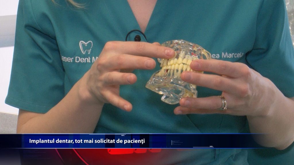 Implantul dentar, tot mai solicitat de pacienti