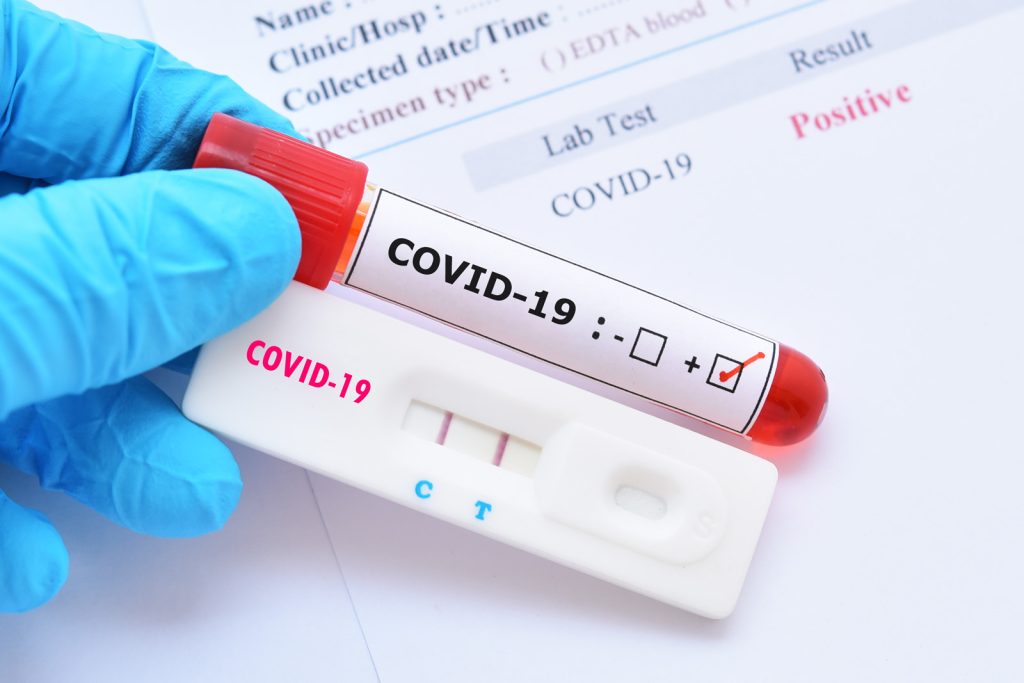 România a depășit pragul de 2000 de cazuri de coronavirus, în ultimele 24 de ore