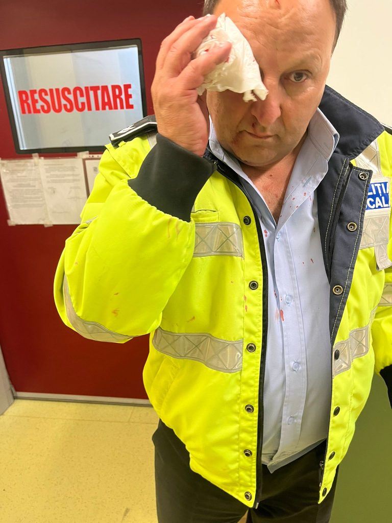 FOTO: Un polițist din Iași a fost agresat de un șofer!