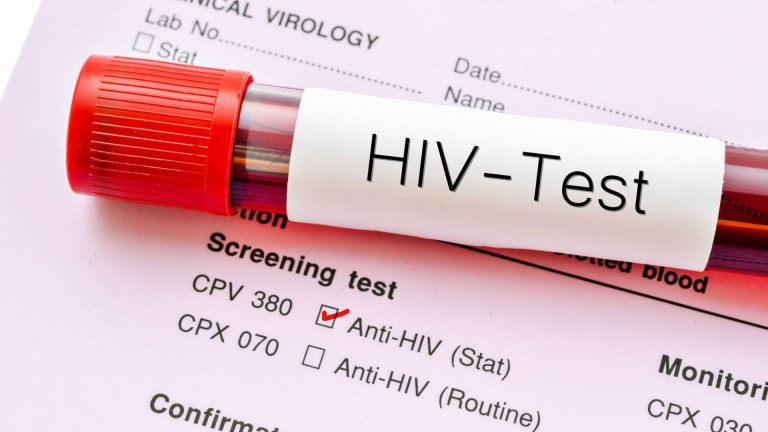 Creşte îngrijorător numărul ieşenilor care află că au HIV. Majoritatea celor care primesc vestea cruntă au sub 24 de ani