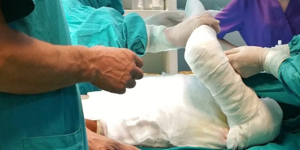 Un barbat de 77 ani a murit la Clinica de Arsi. El avea arsuri de gradul II si IV pe 85% din suprafata corpului