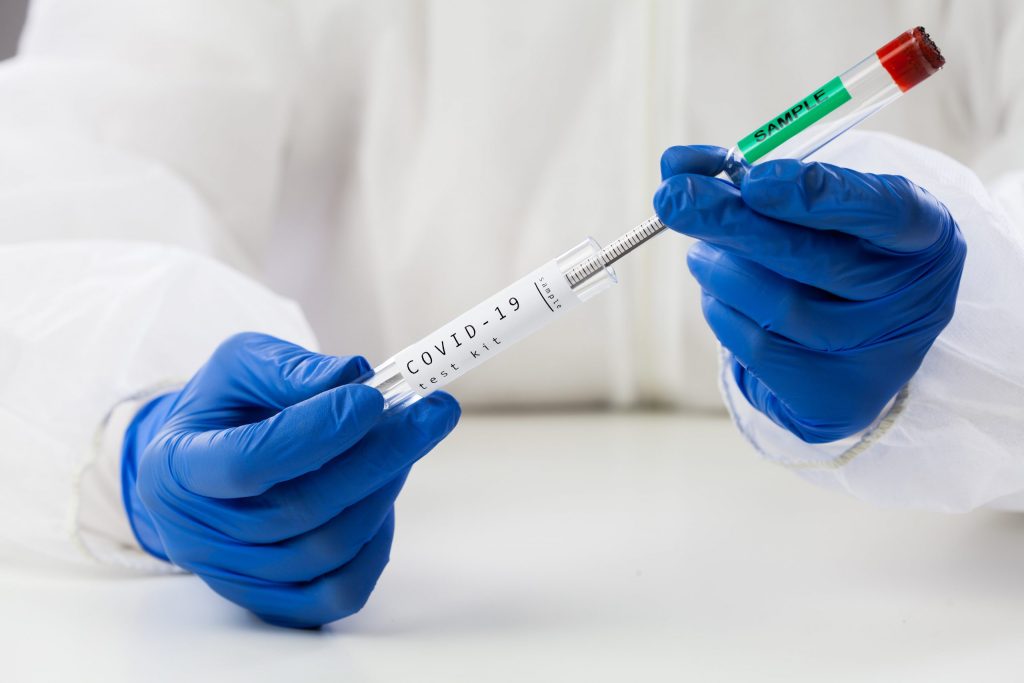 Specialiștii ieșeni au elaborat un test PCR capabil să identifice tulpina și stadiul bolii