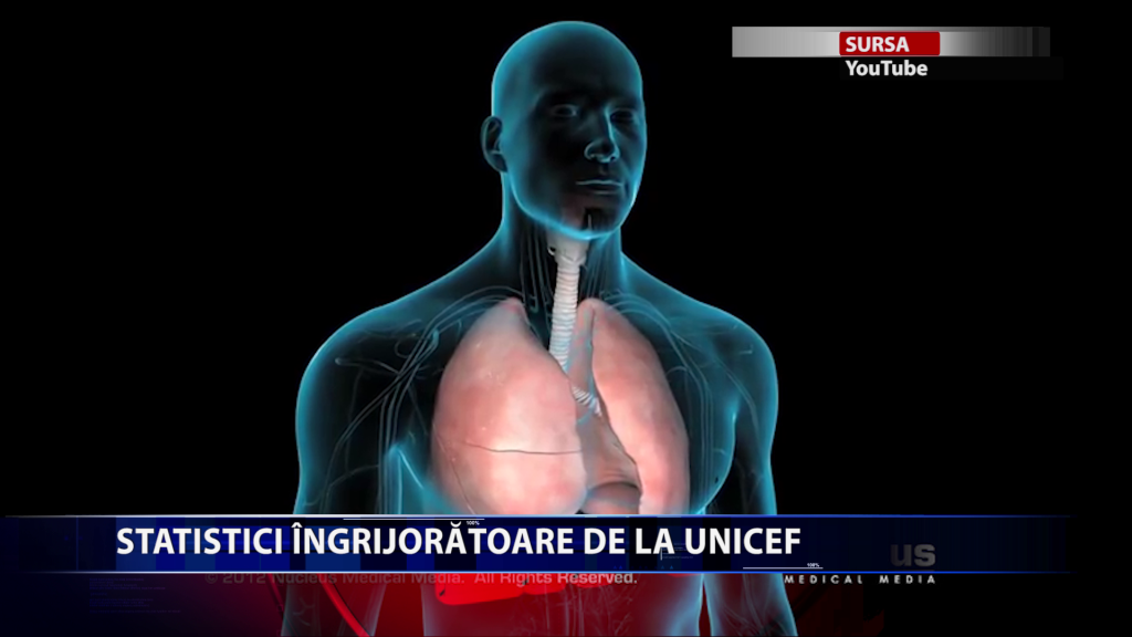Pneumonia a ucis un copil cu varsta sub 5 ani la fiecare 39 de secunde, in 2018