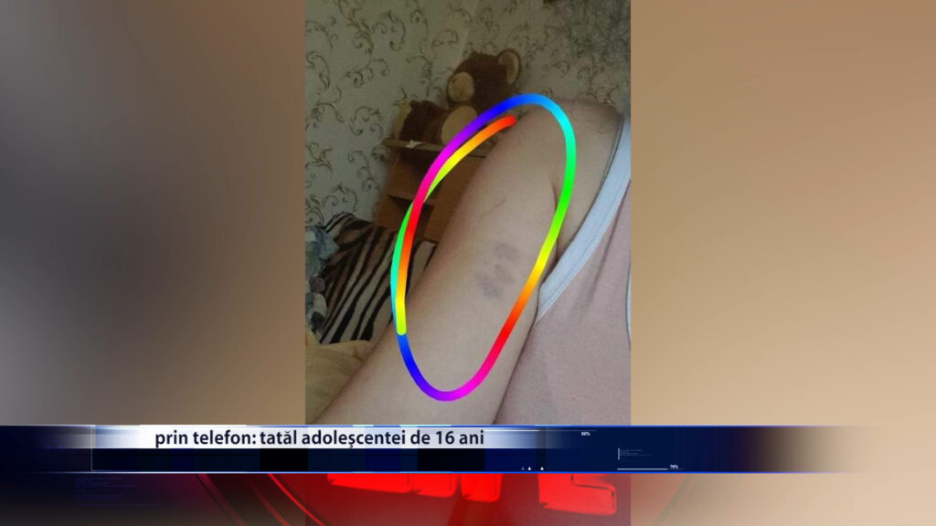 FUGITA DE ACASA DIN CAUZA BATAILOR PARINTILOR