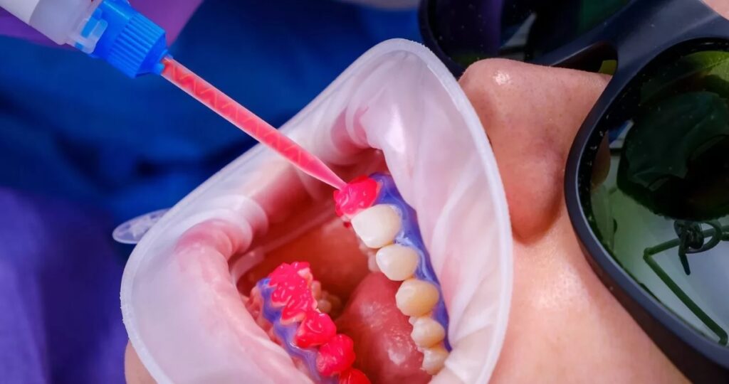 MITURI DESPRE ALBIREA DENTARĂ PROFESIONALĂ – CE TREBUIE SĂ ȘTII ÎNAINTE DE A-ȚI ALBI DINȚII
