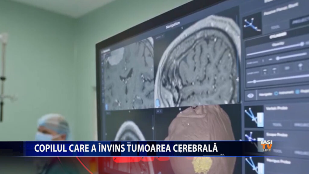 Copilul care a învins tumoarea cerebrală