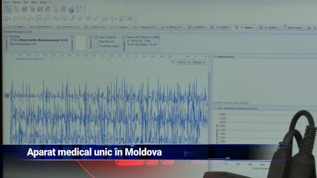 Aparat medical unic în Moldova