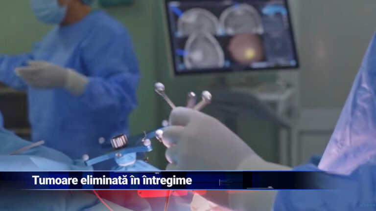 Tumoare eliminată în întregime