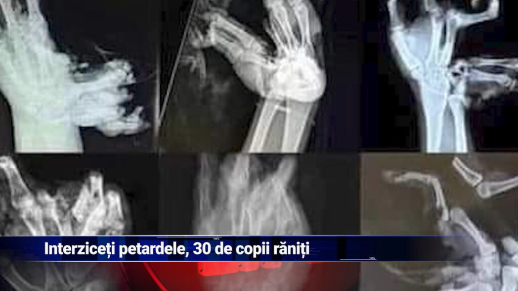 Interziceți petardele! 30 de copii răniți