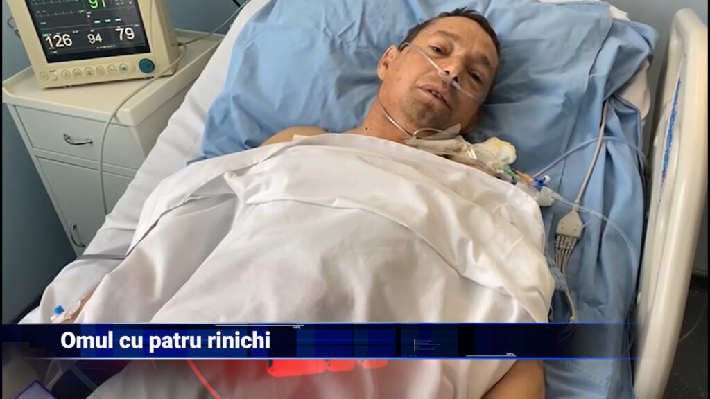 Omul cu patru rinichi
