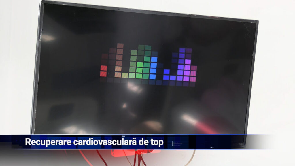 Recuperare cardiovasculară de top