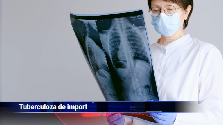 Tuberculoză de import