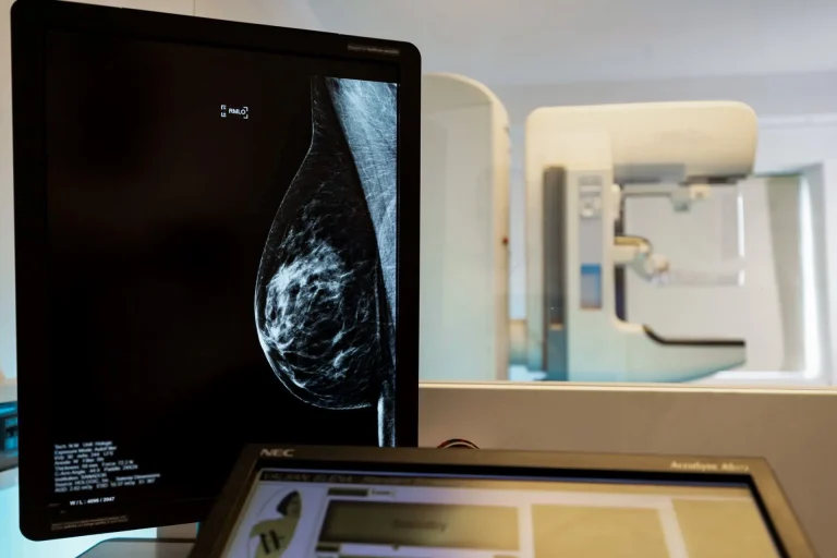 Cum poate fi depistată și tratată din timp o boală frecventă la femei