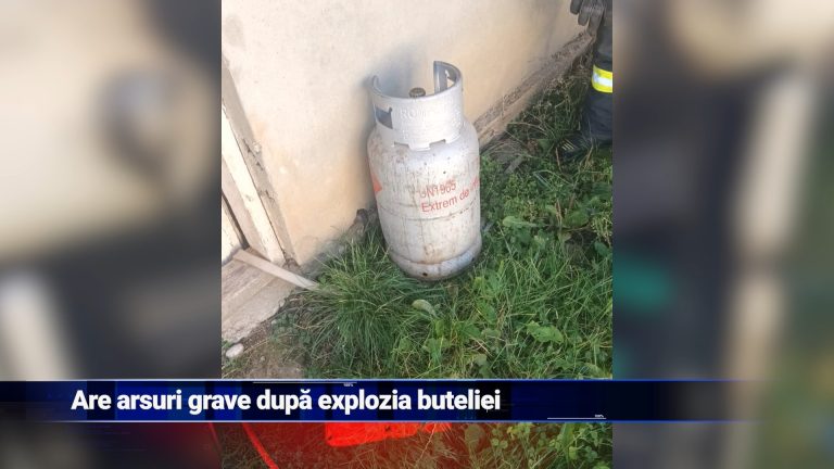 Are arsuri grave după explozia buteliei