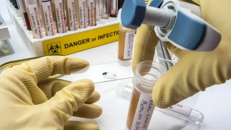 Alertă medicală la Focșani: Două cazuri de botulism confirmate